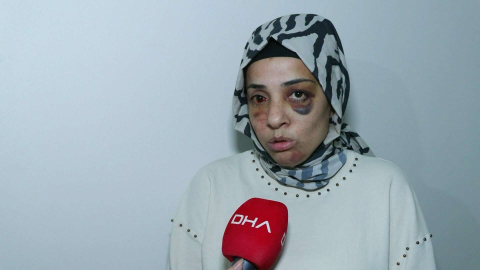 Bağcılar'da eski eşinin ailesi tarafından sokak ortasında dövülen kadının yardım çağrısı